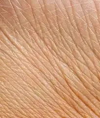 Close-up of fine lines and crepey wrinkling in the skin, a concern treated with BBL HEROic in Southlake, TX