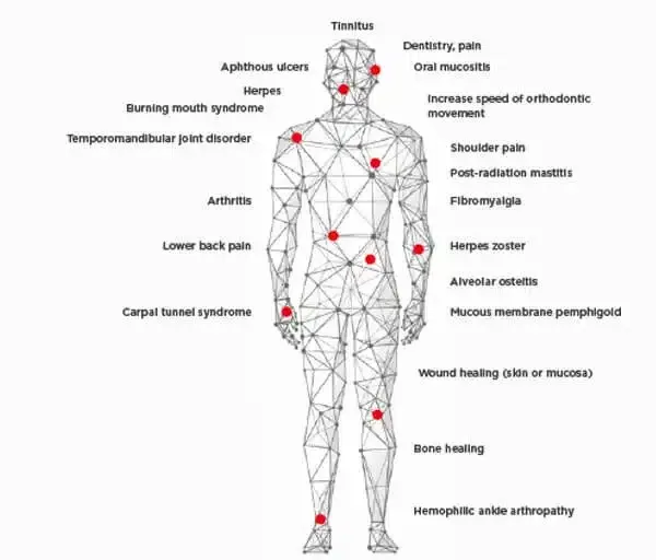 Published photobiomodulation indications map: a body outline with labelled anatomical sites where low-level light therapy has been studied, from tinnitus and oral mucositis down to bone healing and ankle joints