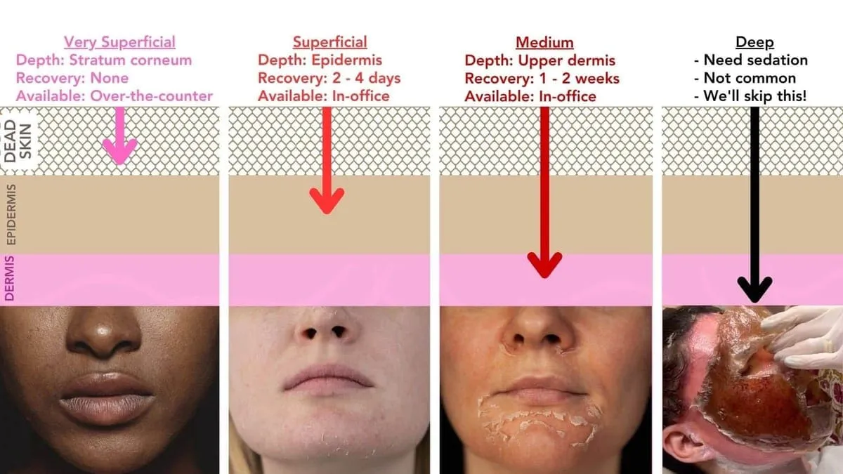 medium chemical peel before and after