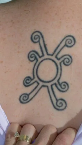 Upper back before laser tattoo removal, showing a black sun symbol with spiral rays between the shoulder blades