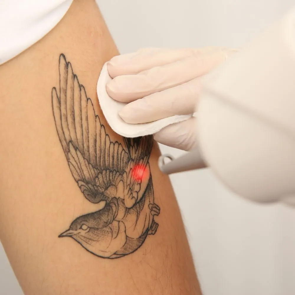 Gloved hands guiding a laser handpiece over a swallow tattoo on an upper arm, a red aiming beam visible on the skin