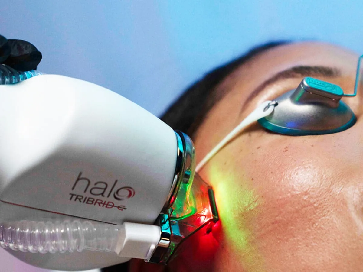 Patient receiving a Sciton Halo Tribrid triple-wavelength laser resurfacing treatment at Medrein Health in Southlake, TX