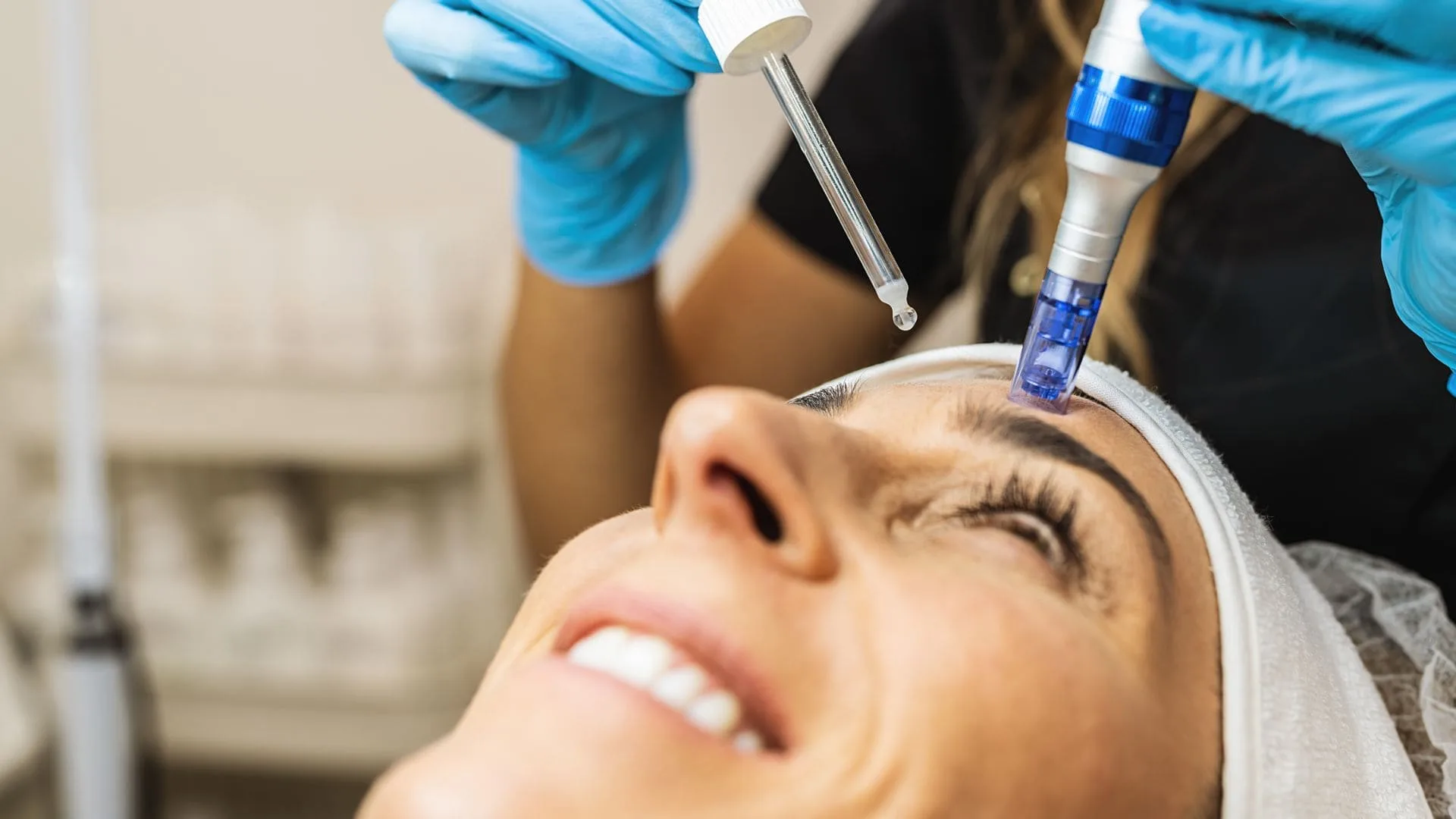 Microneedling with PRP being performed on a patient's cheek, with concentrated platelet serum applied, at Medrein Health in Southlake, TX